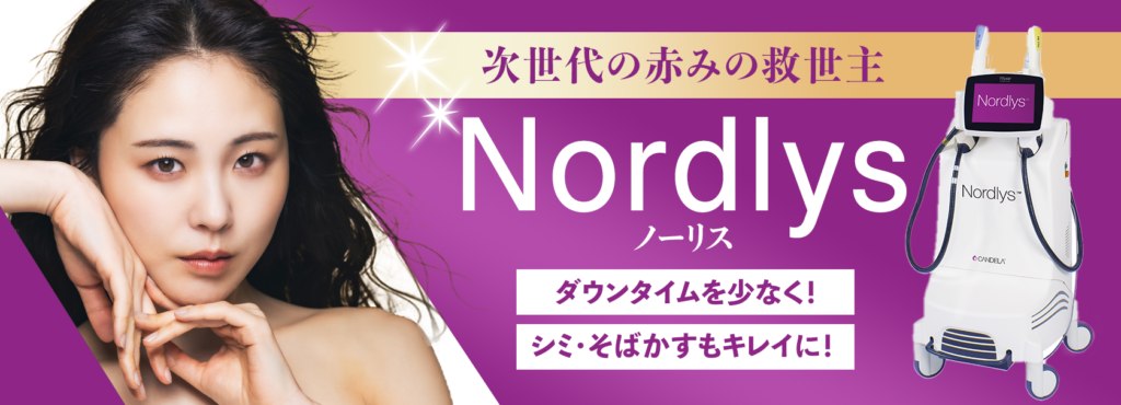 Nordlys（ノーリス）