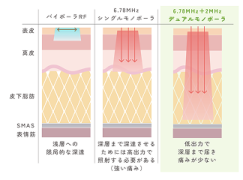 マルチ周波数