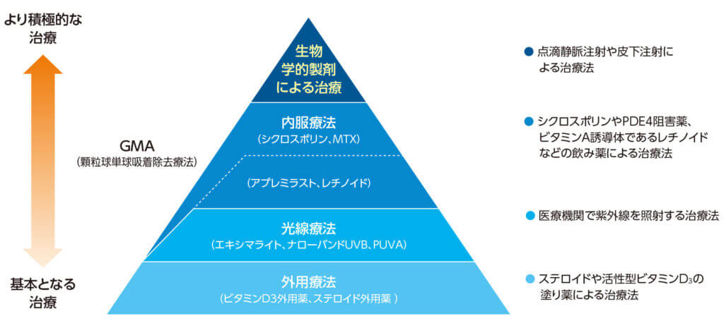 乾癬治療の、順番