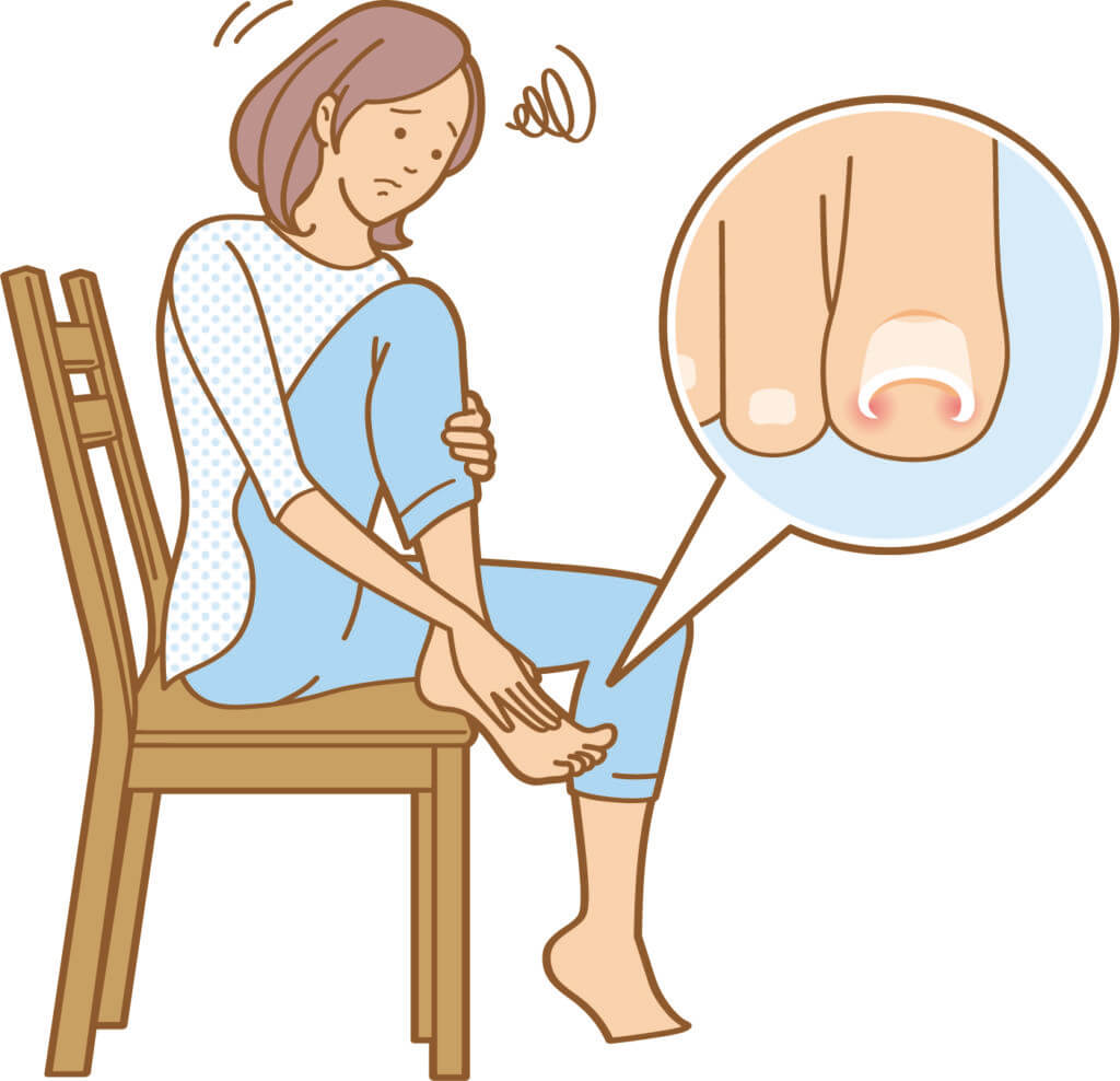 グリーンネイルに悩む女性