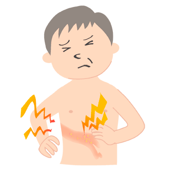 帯状疱疹で痛がる男性