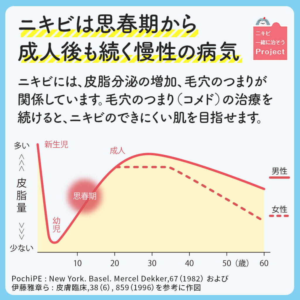 ニキビは思春期後も継続的な治療が必要です