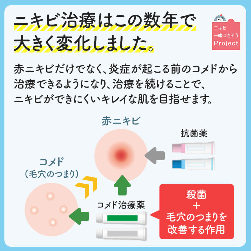 ニキビ治療におけるピーリング剤の重要性